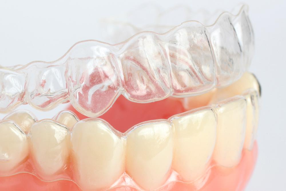 close up of clear plastic aligner on teeth | clear aligner therapy cookeville tn