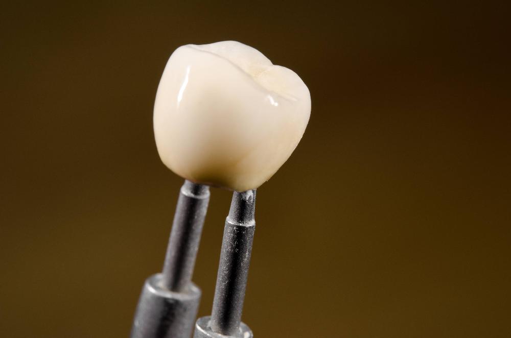 close up of dental crown in jaw | dental crowns cookeville tn