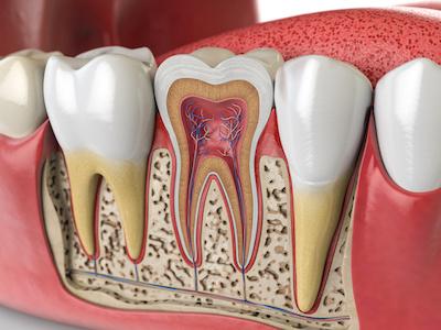 inside of infected tooth | root canal cookeville tn