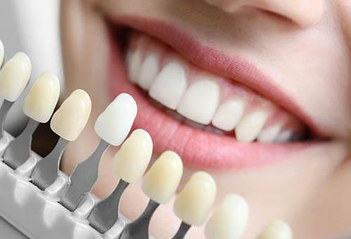 patient choosing tooth whitening shade | cosmetic dentistry cookeville tn