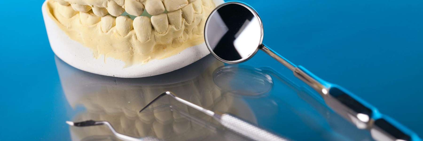 close up of mouth mold | dentist cookeville tn