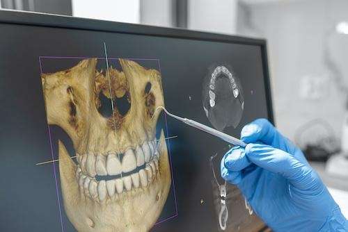 close up of cone beam technology | dental implants cookeville tn