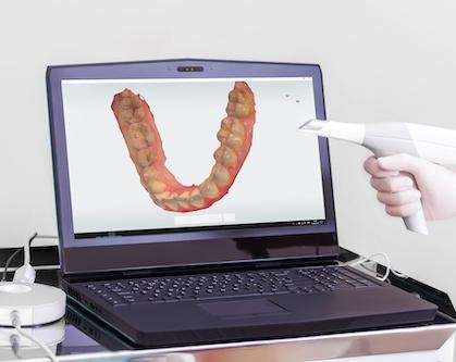 close up of intraoral scanner | dentist cookeville tn