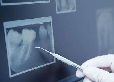 close up of digital x-ray | cookeville dentist office